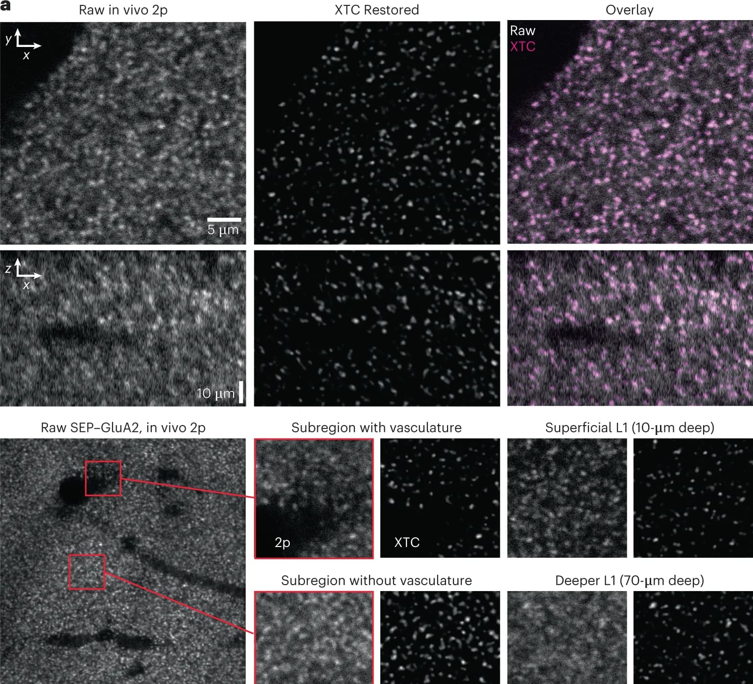 Open access visualization of Microscopy, In Vivo Imaging, Two-Photon Microscopy, XTC, Cortex