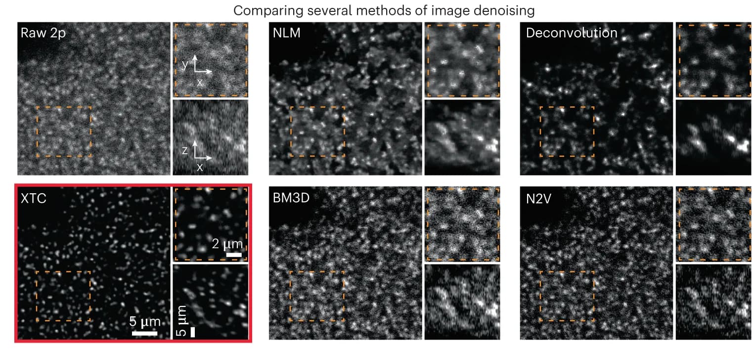 Open access visualization of Microscopy, XTC Restoration, Algorithms, NLM, Deconvolution