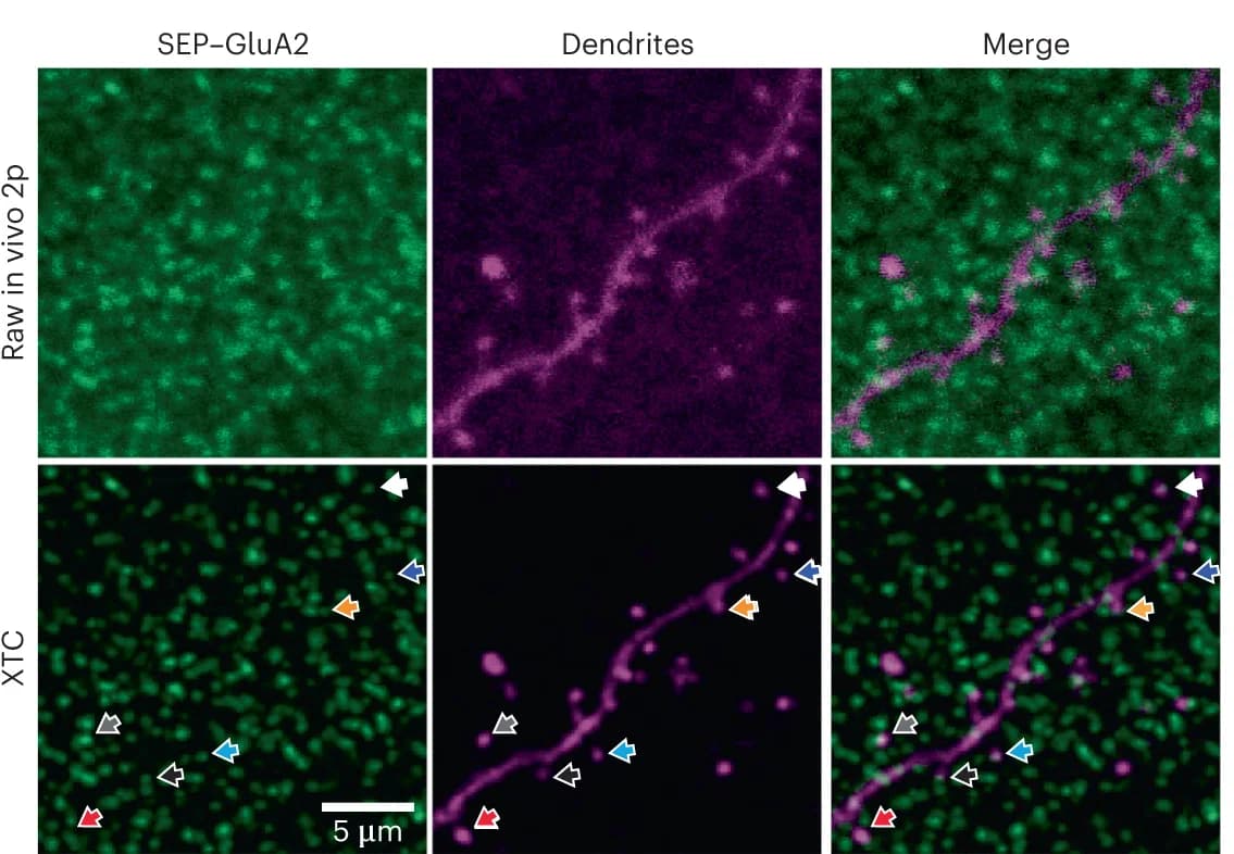 Open access visualization of Microscopy, XTC Model, In Vivo, Fluorescent Signals, Dendrite