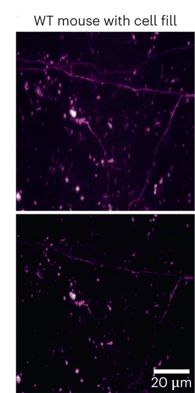 Open access visualization of Microscopy, XTC Model, Wild-Type Mice, SEP-GluA2 Synapses, tdTomato