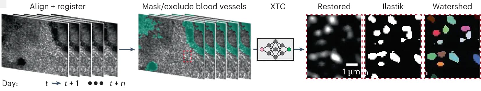 Open access visualization of Workflow, Illustration, Preprocessing Pipeline, In Vivo 2P Microscopy, Blood Vessels