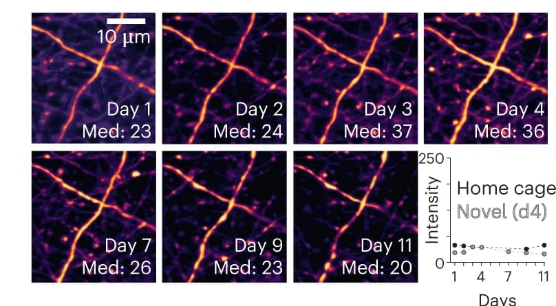 Open access visualization of Microscopy, Line Plot, Signal Intensity, SEP Signal, Red Cell Fill
