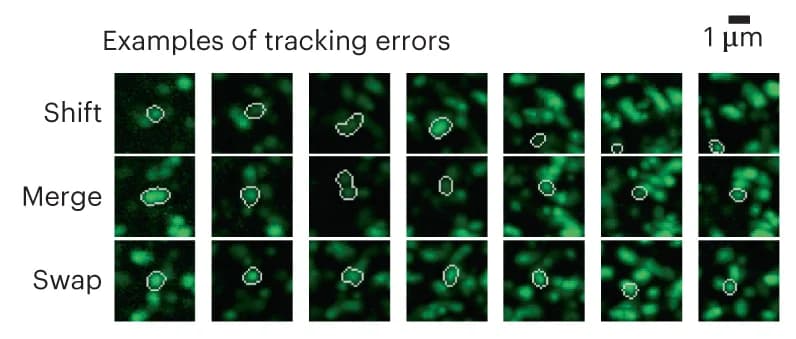 Open access visualization of Microscopy, Error Types, Synapse Tracking, Scale Bar