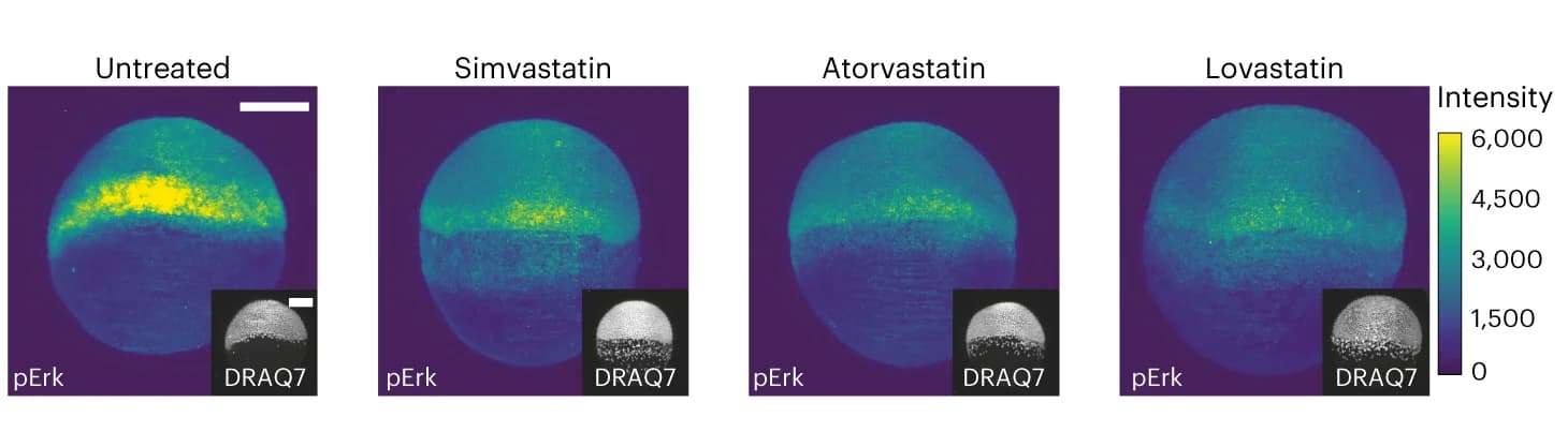 Open access visualization of Microscopy, Immunofluorescence images, FGF signaling transducer pErk, Untreated embryos, Statin-treated embryos