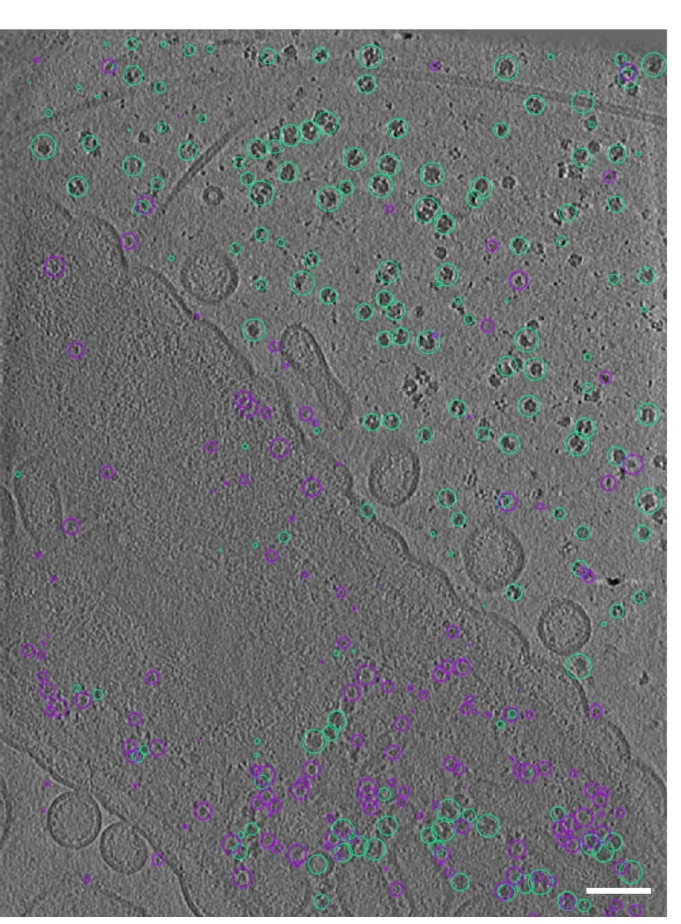 Open access visualization of Microscopy, Tomogram, Y. entomophaga cell, Clusters