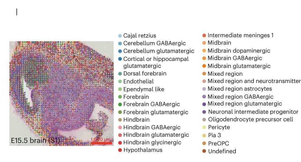Open access visualization of Microscopy, Scatter Plot, Spatial RNA, Single-Cell Deconvolution, E15.5 Brain