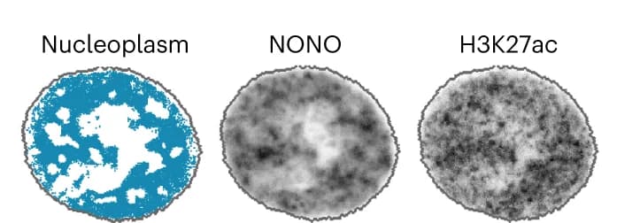 Open access visualization of Microscopy, Channel, CSLs, Distribution