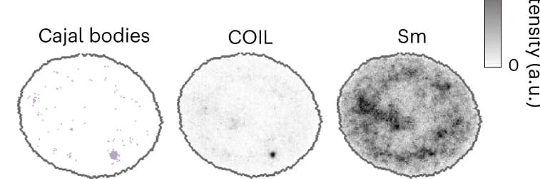 Open access visualization of Microscopy, Channel, CSLs, Distribution