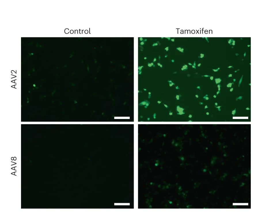 Open access visualization of Microscopy, SELECTIV-Pax7 CE Myoblasts, Tamoxifen Treatment, AAV2-GFP, AAV8-GFP