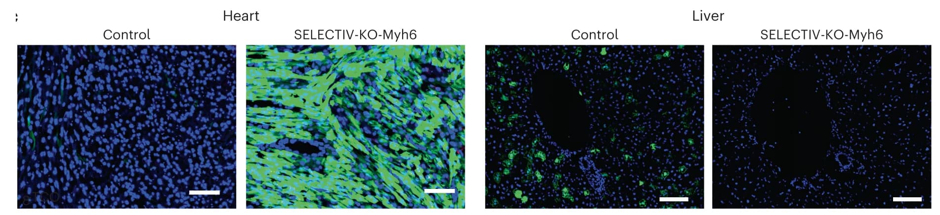 Open access visualization of Microscopy, Control Mice, SELECTIV-KO-Myh6 Mice, Heart-Specific, PHP.eB-GFP