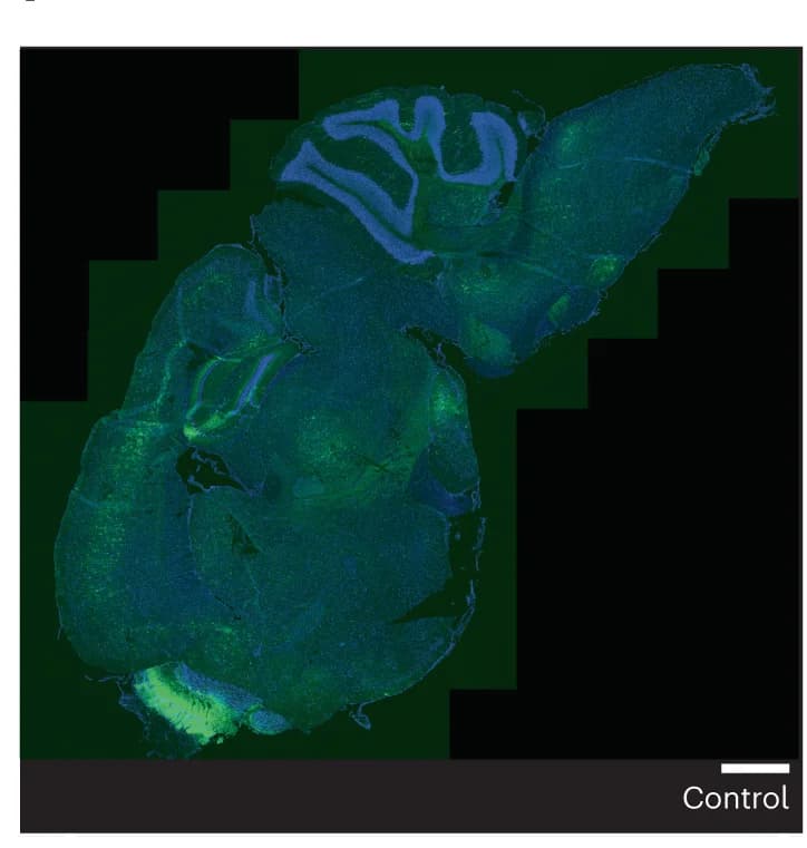 Open access visualization of Microscopy, Fluorescence Microscopy, Brain Slices, Control Mouse, GFP