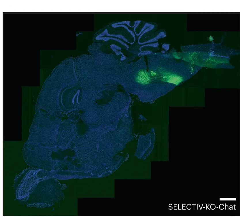 Open access visualization of Microscopy, Fluorescence Microscopy, Brain Slices, SELECTIV-KO-Chat Mice, AAVR
