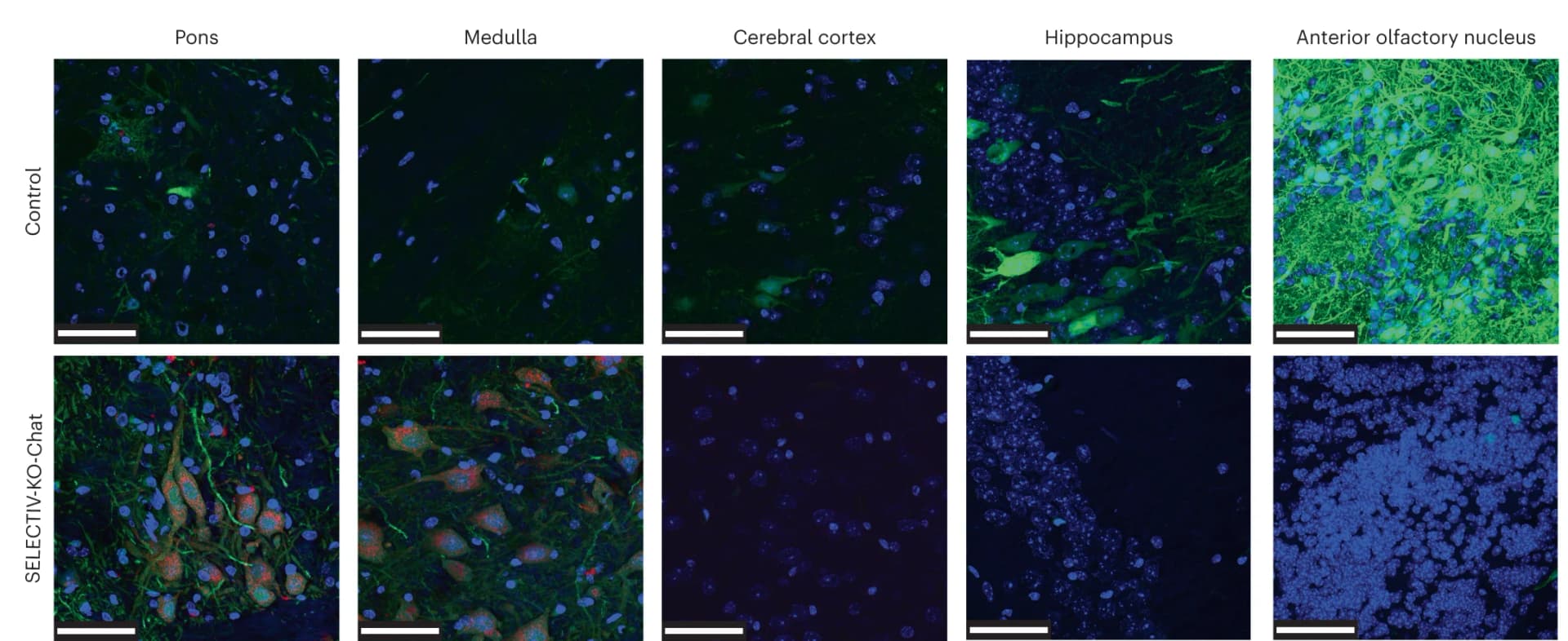 Open access visualization of Microscopy, Brain Slices, AAVR-mCh Expression, Cholinergic Neurons, Pons