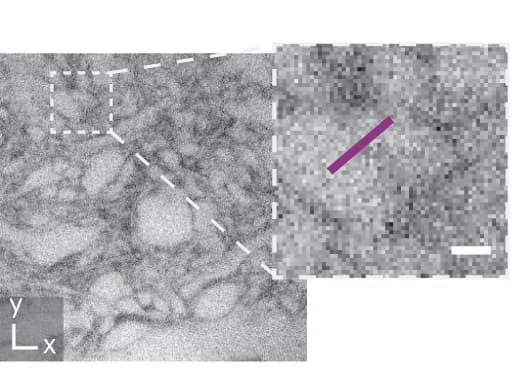 Open access visualization of Microscopy, STED Imaging, CA1 Neuropil, Hippocampal Slice, Phase Modulation