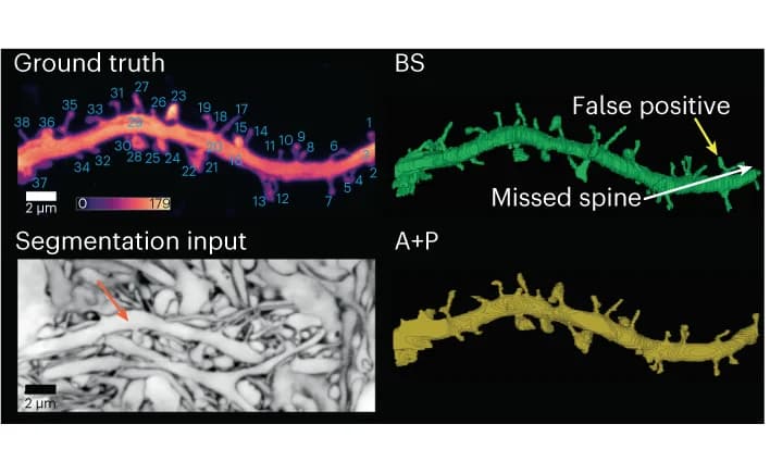 Open access visualization of Microscopy, Dendrite, Hippocampal Slice Culture, eGFP, Spine Detection