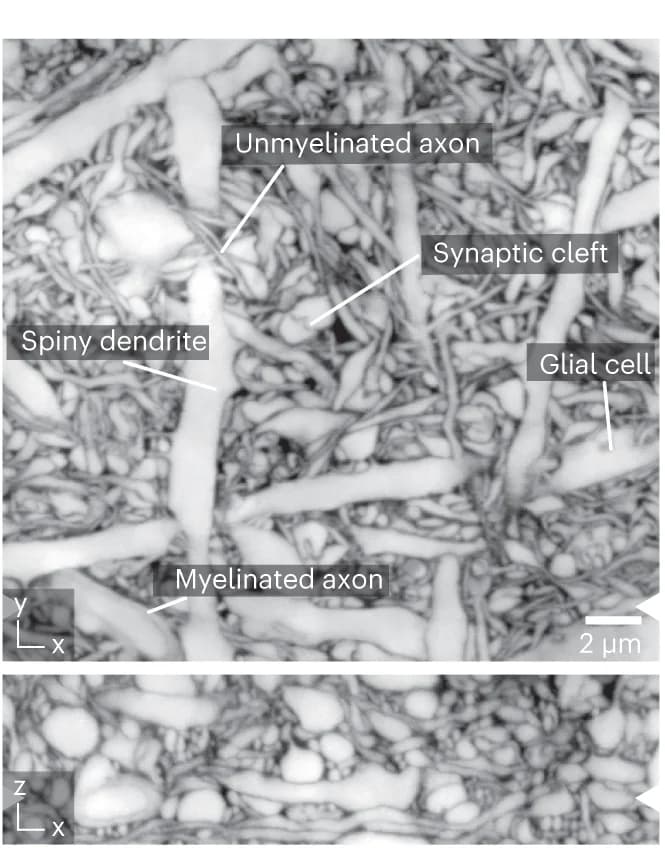 Open access visualization of Microscopy, LIONESS volume, Neuropil, Hippocampal slice