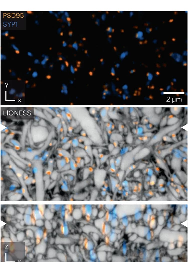 Open access visualization of Microscopy, Confocal Image, CA1 Neuropil, Hippocampal Slice Culture, PSD95-HaloTag