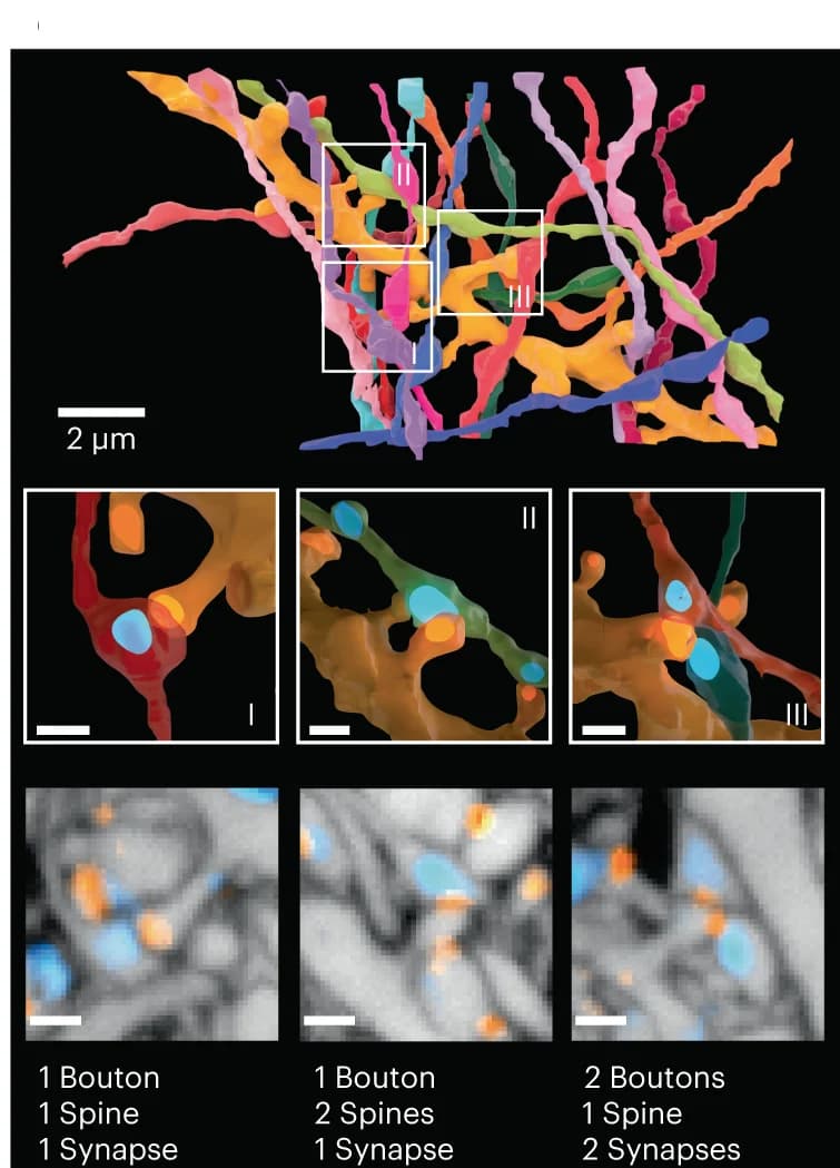 Open access visualization of Microscopy, 3D Reconstruction, Dendrite, LIONESS Volume, Synaptically Connected Axons