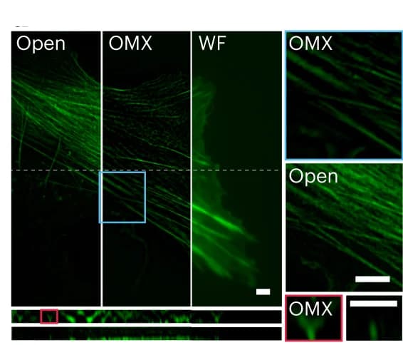 Open access visualization of Microscopy, Actin Filaments, U2OS Cell, OMX, Signal-to-Noise Ratio