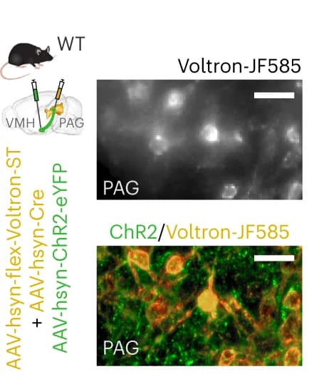 Open access visualization of Microscopy, Illustration, Viral Expression, ChR2, VMH-PAG Pathway