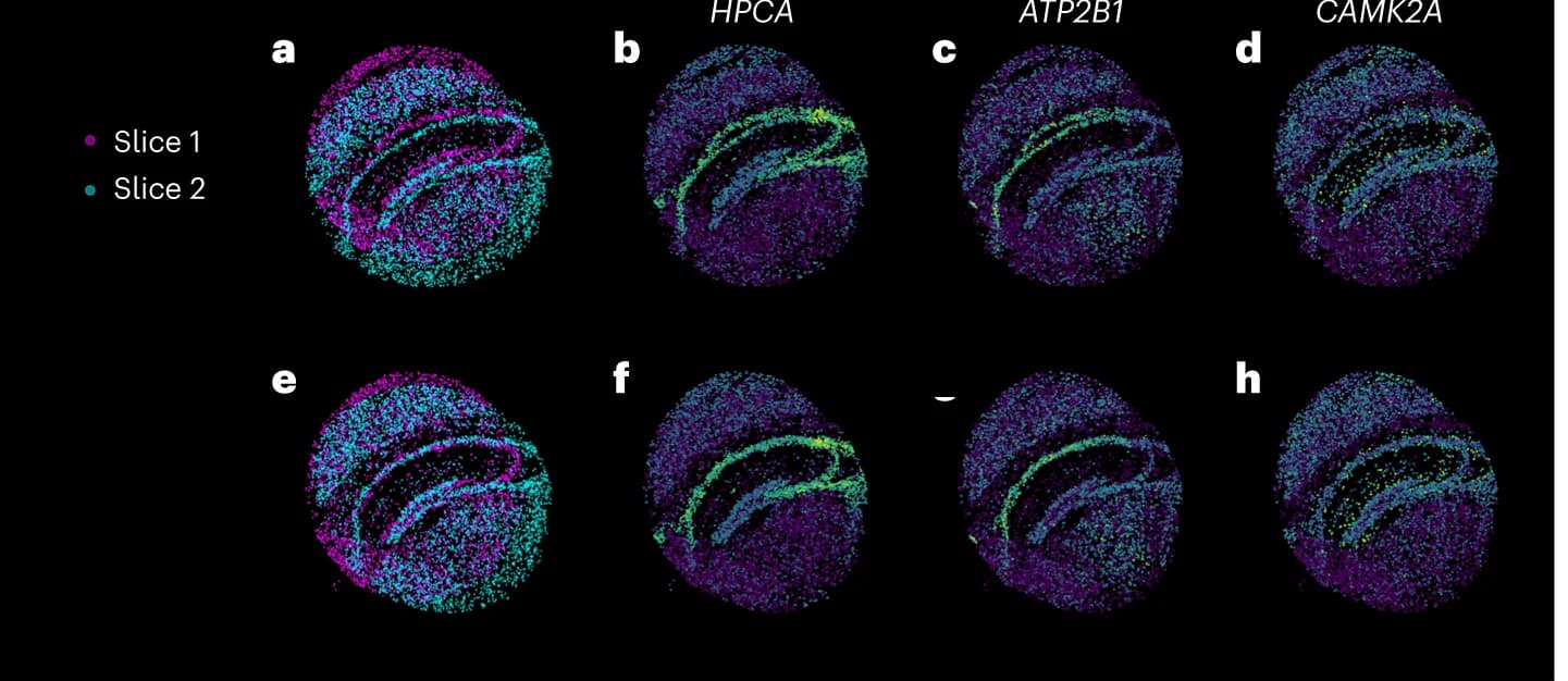 Open access visualization of Scatter Plot, Slices, Gene Expression, ATP2B1, Alignment