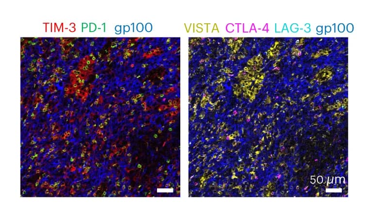 Open access visualization of Microscopy, SABER-IMC, Immunomodulatory Molecules, Inflamed Melanoma, gp100