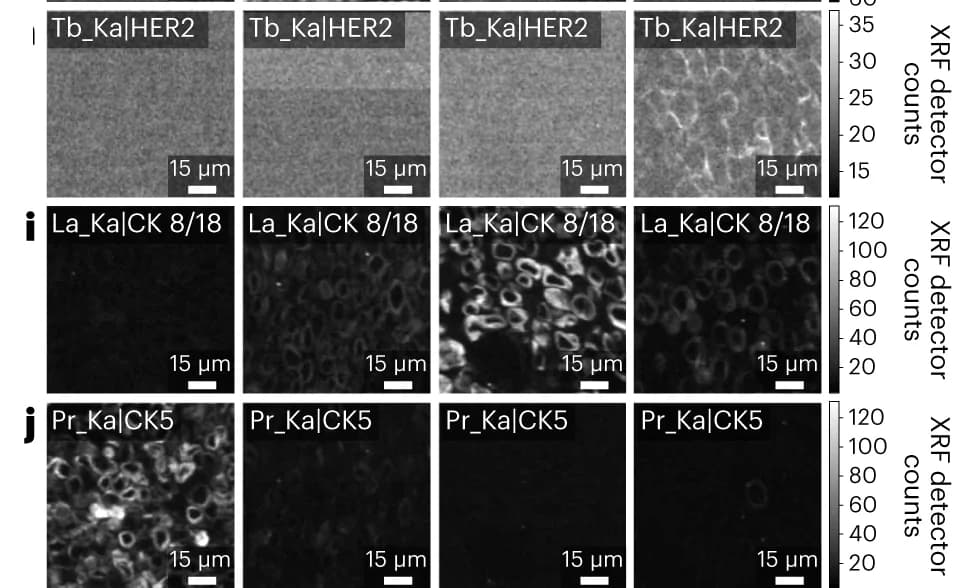 Open access visualization of Microscopy, MEZ-XRF, Breast Epithelial Cell Lines, Tb_Ka|HER2