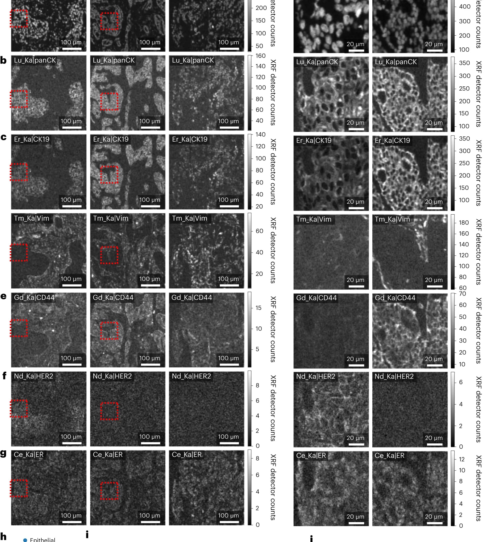 Open access visualization of Microscopy, MEZ-XRF, HER2, Luminal A, Luminal B