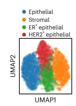 Open access visualization of Scatter Plot, UMAP, Leiden clustering, Single Cells, Overview Images