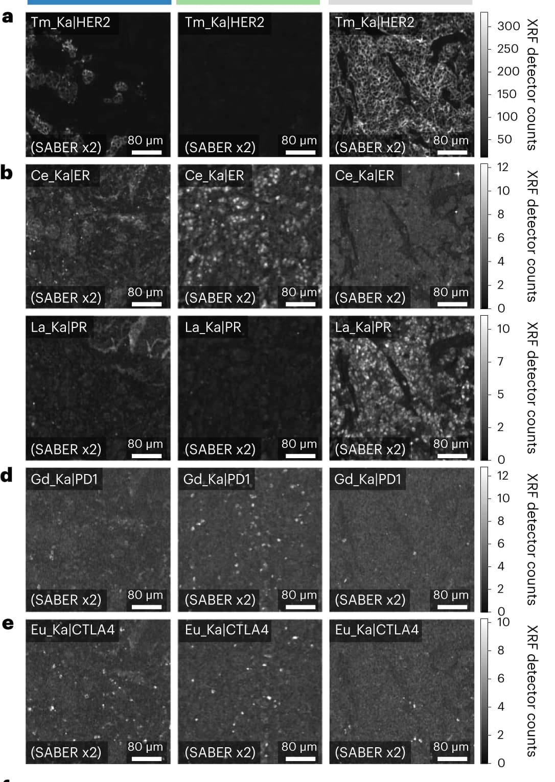Open access visualization of Microscopy, MEZ-XRF, SABERx2 Z-tags, Breast Tumor Tissue, HER2