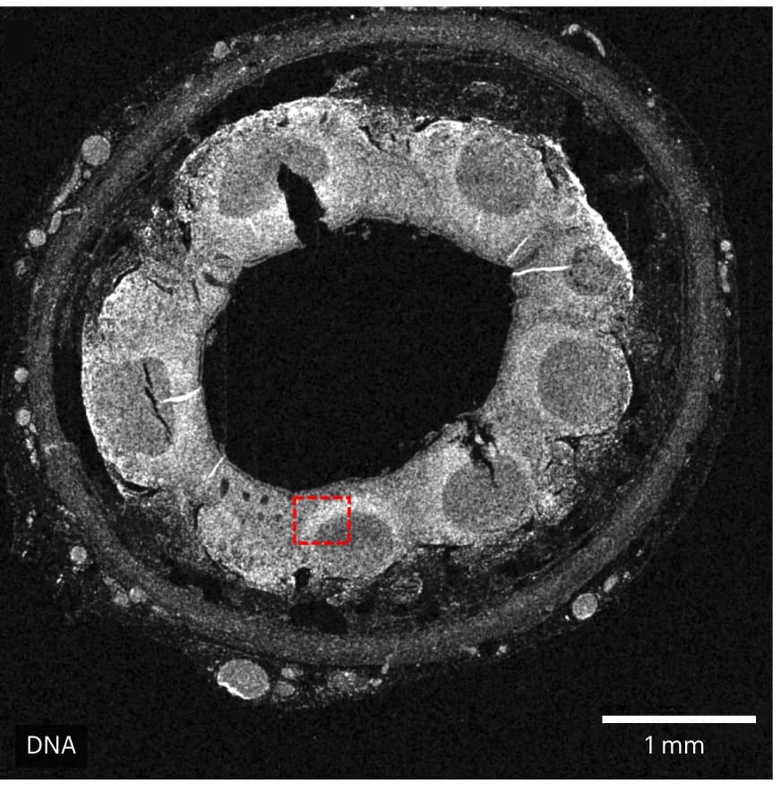 Open access visualization of Microscopy, Appendix, MEZ-XRF