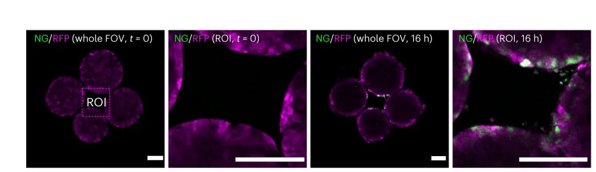 Open access visualization of Microscopy, Live Imaging, Organoids, Pulsed Photostimulation, RFP