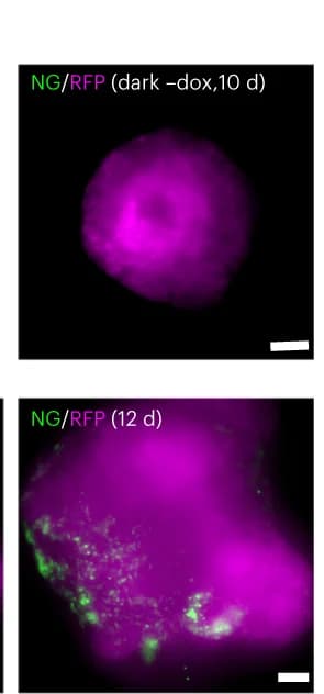 Open access visualization of Microscopy, Live Imaging, Control Organoid, RFP, NG