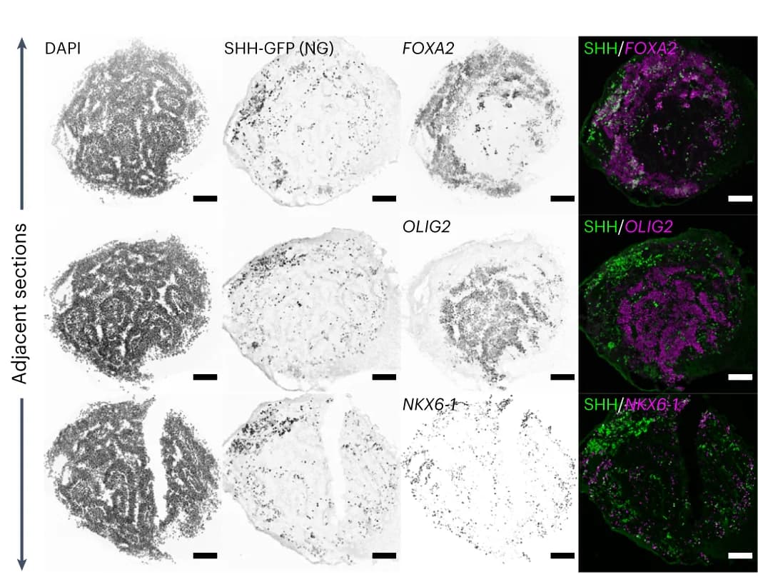 Open access visualization of Microscopy, DAPI, SHH-expressing Cells, NG, FOXA2