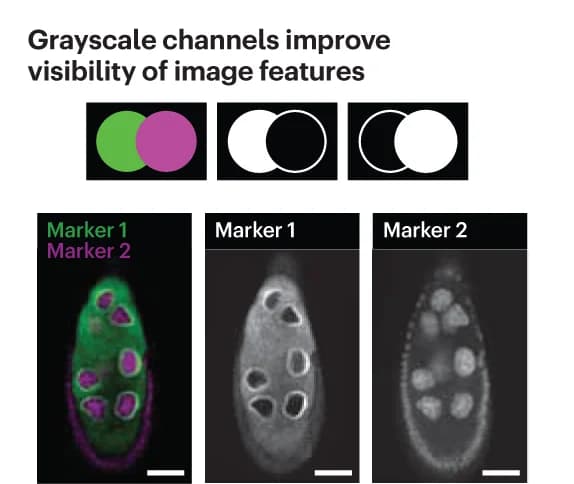 Open access visualization of Microscopy, Grayscale, Image Details