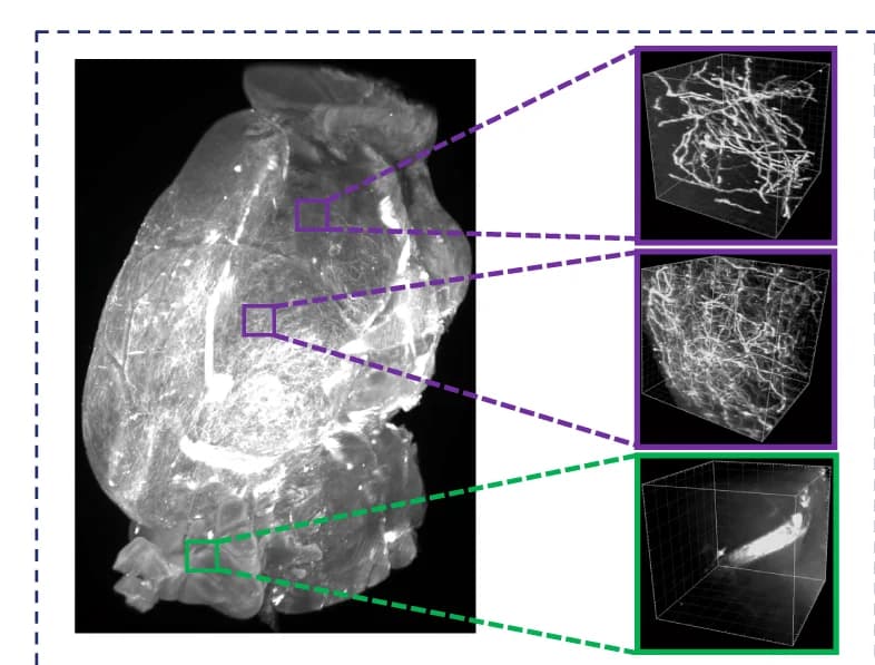 Open access visualization of Microscopy, 3D Whole Brain, Sparse Axons, Dense Axons, Artifacts