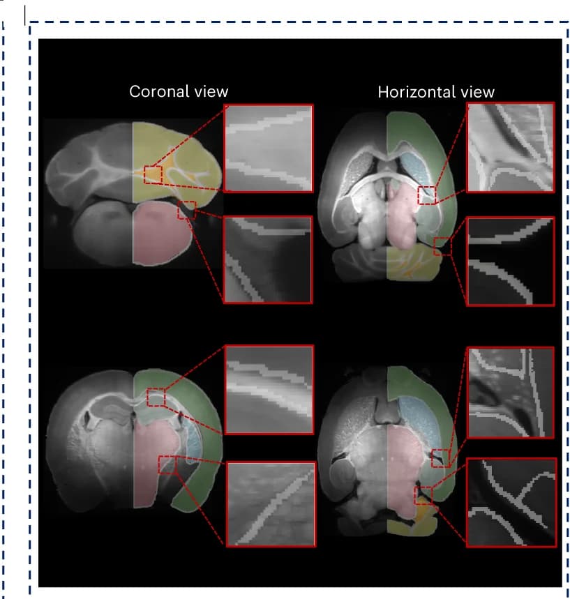 Open access visualization of Microscopy, Brain Region Segmentation, Coronal View, Horizontal View, CTX