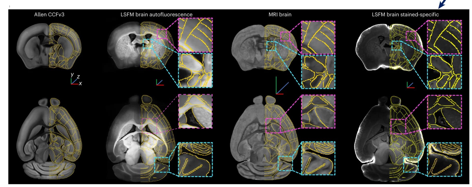 Open access visualization of Microscopy, Registration, LSFM Brain, Autofluorescence Channel, MRI Brain