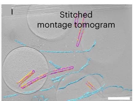 Open access visualization of Microscopy, Segmentation