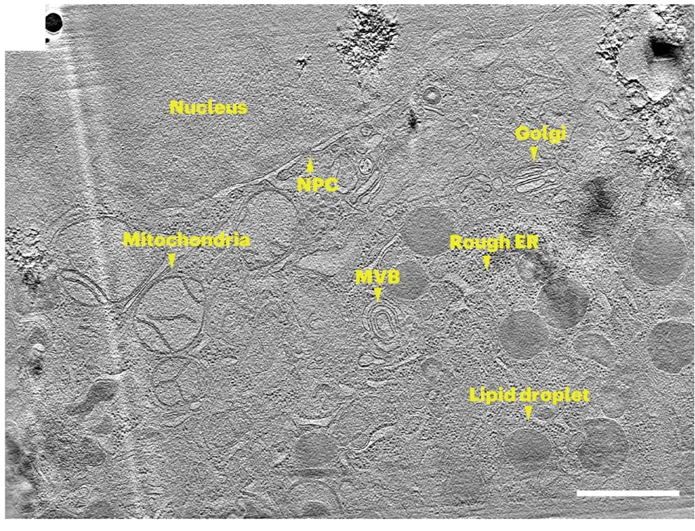 Open access visualization of Microscopy, Tomographic slice, Tomogram