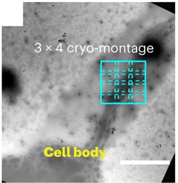 Open access visualization of Microscopy, cryo-EM, cryo-ET, Montage, Cell body