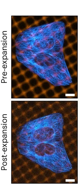 Open access visualization of Microscopy, U2OS Cells, GelMap grids, Tubulin, Myc-tag