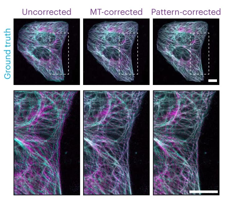 Open access visualization of Microscopy, Tubulin, Transformation, Pattern correction, Ground-truth image