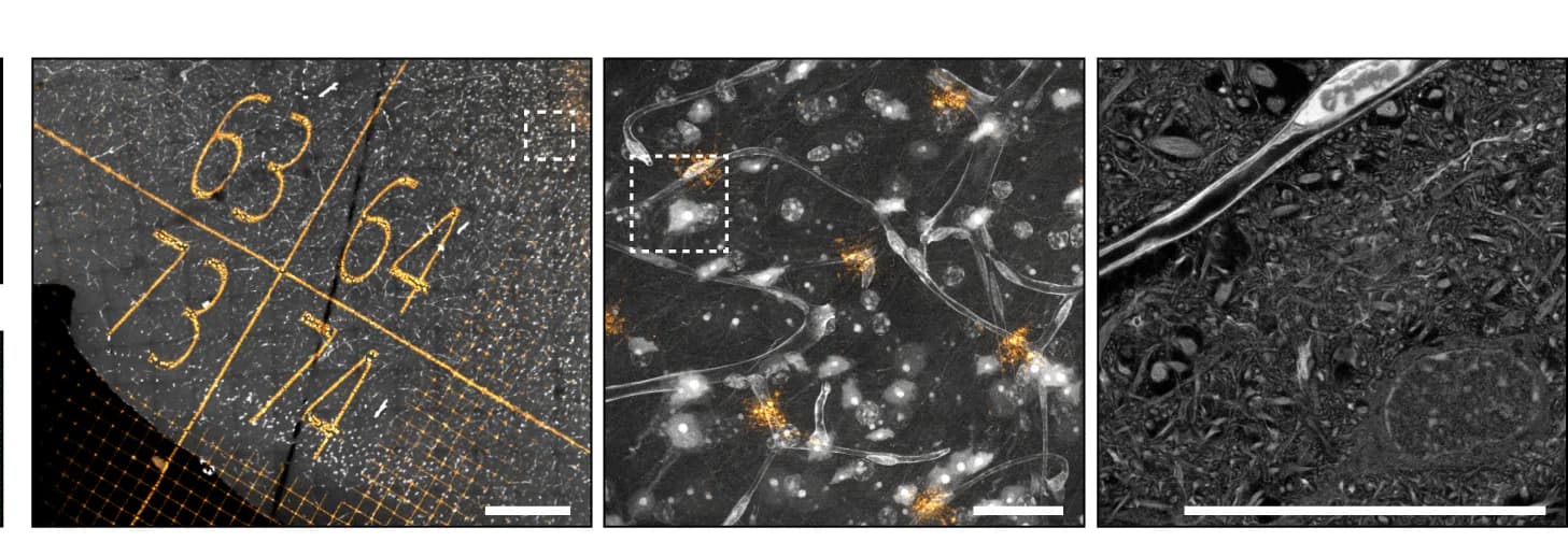 Open access visualization of Microscopy, GelMap, Tissue Vasculature, Blood Vessel, High-Resolution Zoom