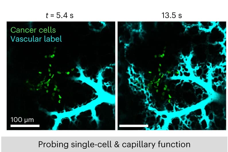 Open access visualization of Microscopy, Capillary Function, Lung Cancer, Real-Time Confocal Microscopy, Cascade Blue Dextran
