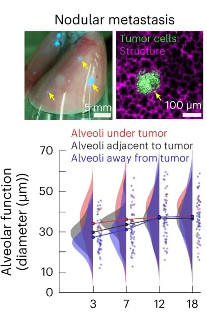 Open access visualization of Line Plot, Ridge Plot, Scatter Plot, Tumors, Alveolar scale