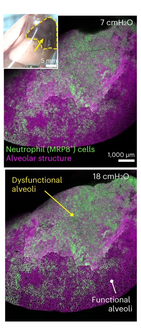 Open access visualization of Microscopy, Photo, Confocal Microscopy, Alveolar Pressure, Lung