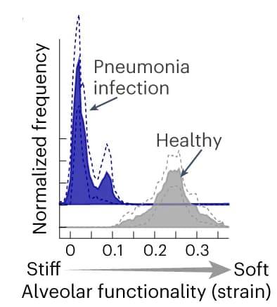 Open access visualization of Density Plot, Line Plot, Strain Distribution, Pneumonia, Healthy Lung