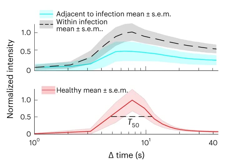 Open access visualization of Line Plot, Error Bars, Fluorescence Intensity, Capillaries, Pneumonia