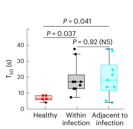 Open access visualization of Box Plot, Scatter Plot, Fluorescence Intensity, Capillary Bed, Pneumonia